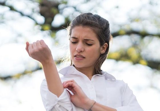 अब नहीं सताएगीं घमोरियां..……